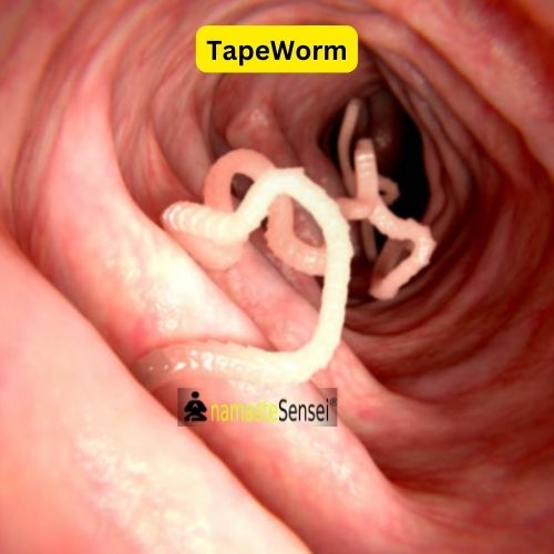 sixth example of acoelomates, tapeworm