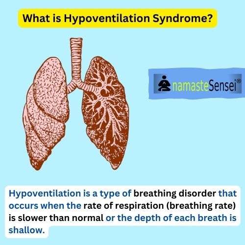 what is hypoventilation syndrome | hypoventilation syndrome medical definition